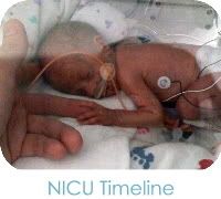 NICU Timeline